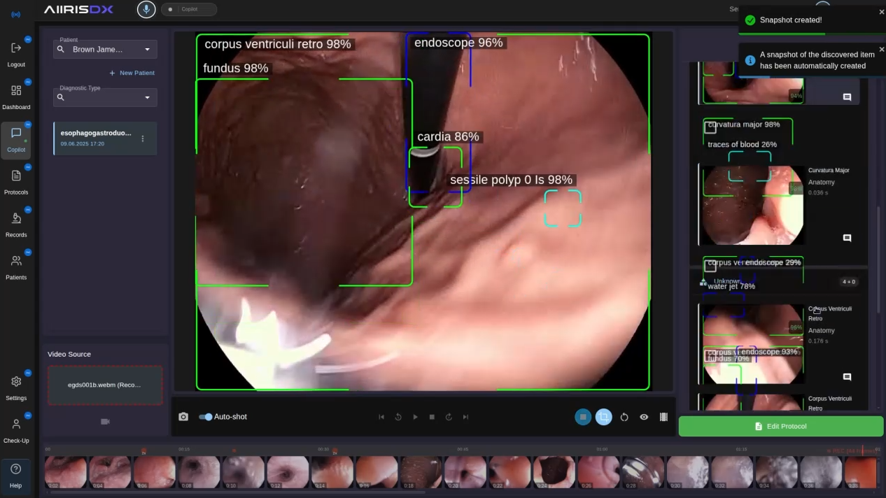 AiirisDX: AI-assisted endoscopy product interface
